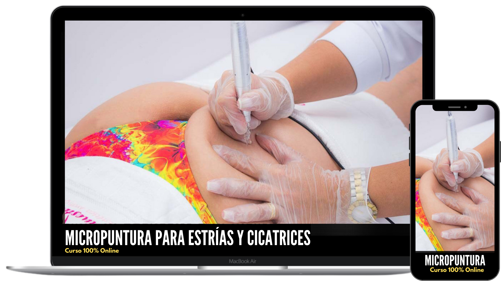 Curso Micropuntura Yess Lacroix 2 Pantallas