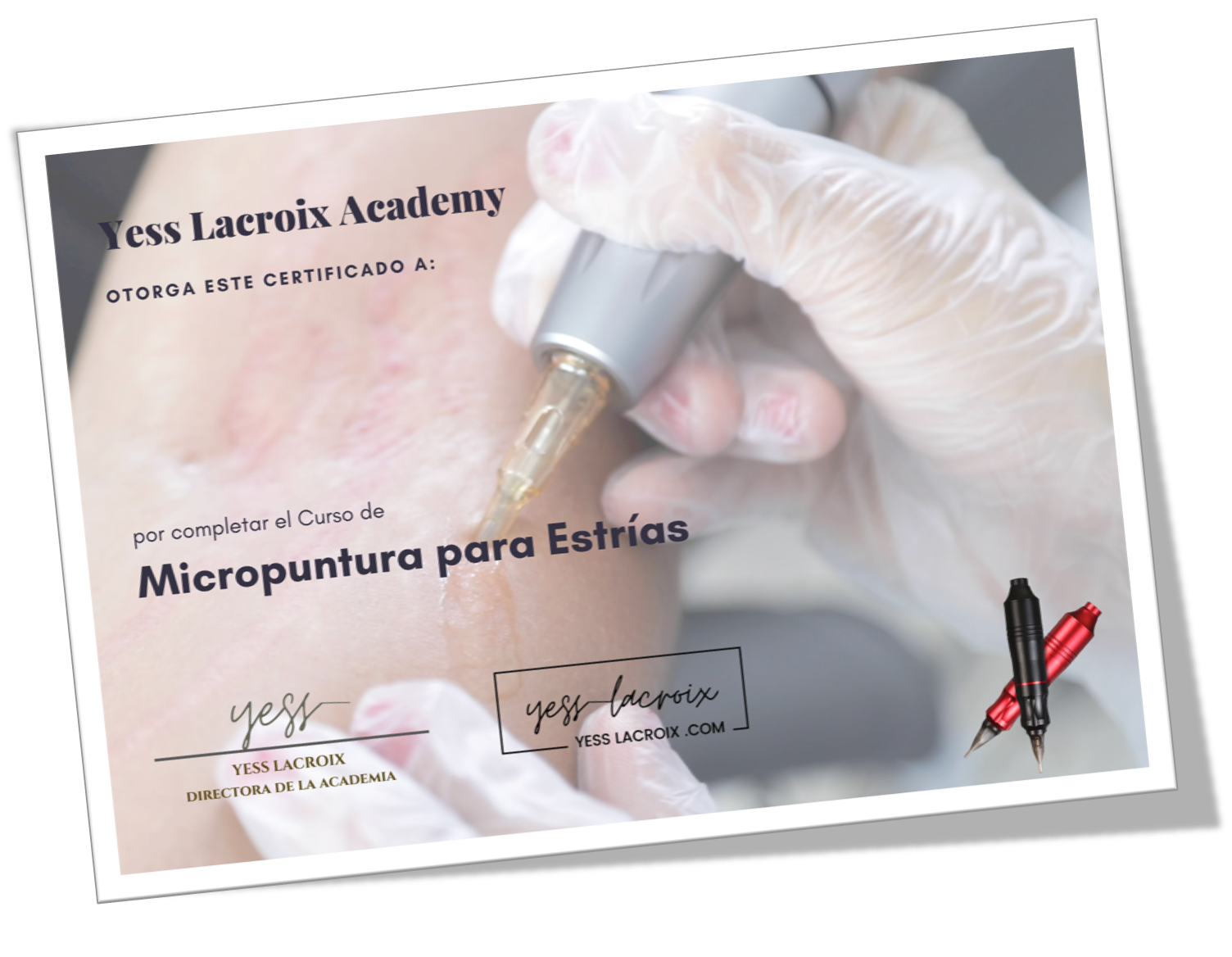 MICROPUNTURA