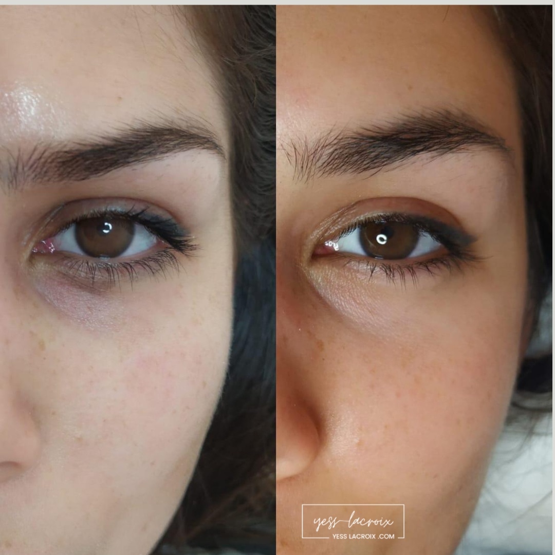 Camuflaje de Ojeras antes y despues